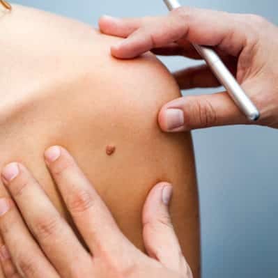 Dermatologia Cirúrgica l Grupo Dra Caroline Antunes
