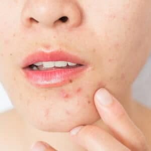 Dermatologia clínica