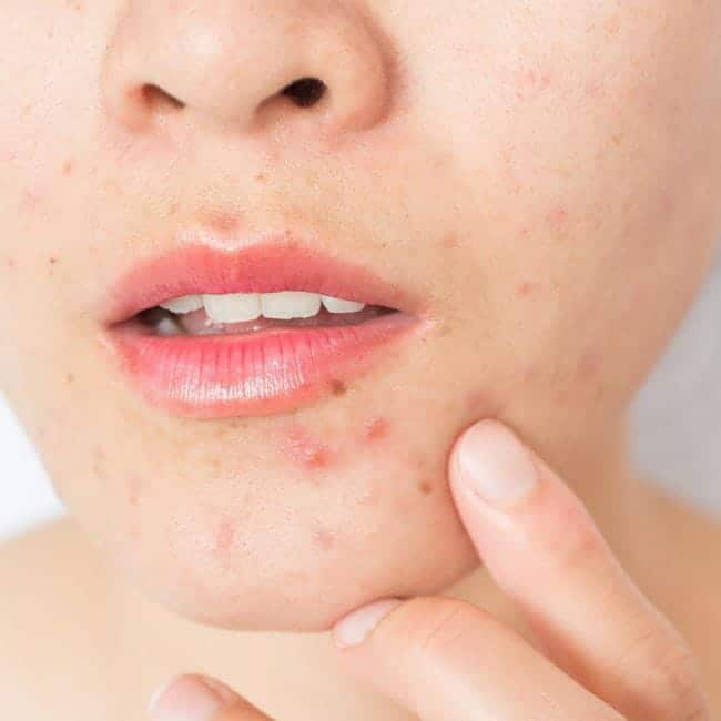 Dermatologia clínica