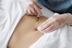 lipo enzimática